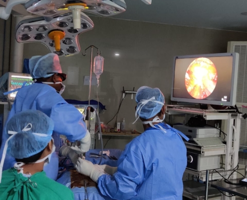 Endoscopic Discectomy by 3D camera